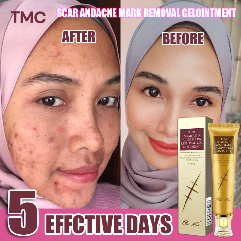 TCM Scar Andacne Mark Removal Gelointment 30g Obat Penghilang Bekas Luka Lama Hitam Koreng Bakar Kna