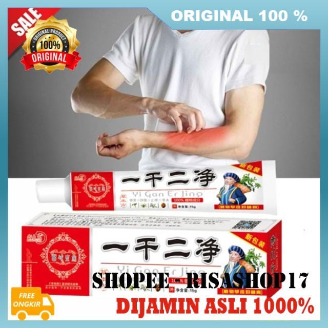Salep Ajaib Yi Gan Er Jing Salep Gatal, Panu, Kurap, Eksim, Jamur Ampuh Untuk Dewasa dan Anak-anak 1