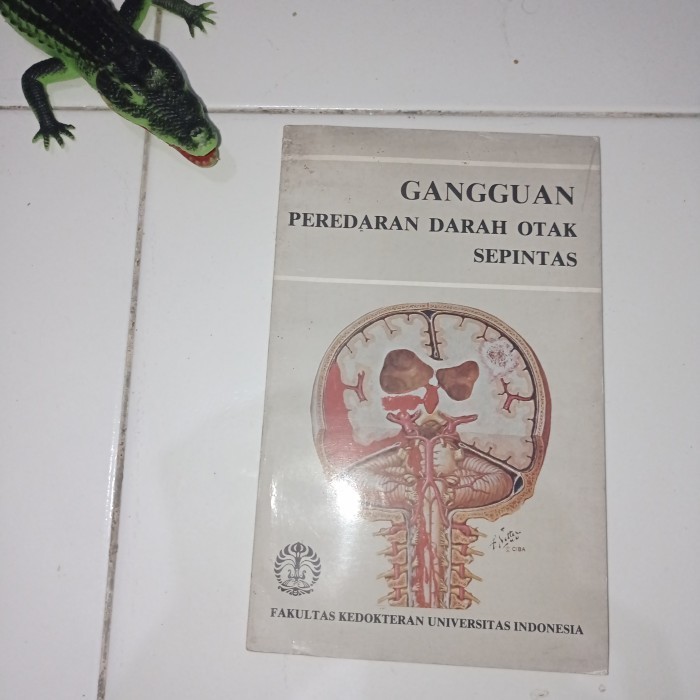 Gangguan Peredaran Darah Otak Sepintas