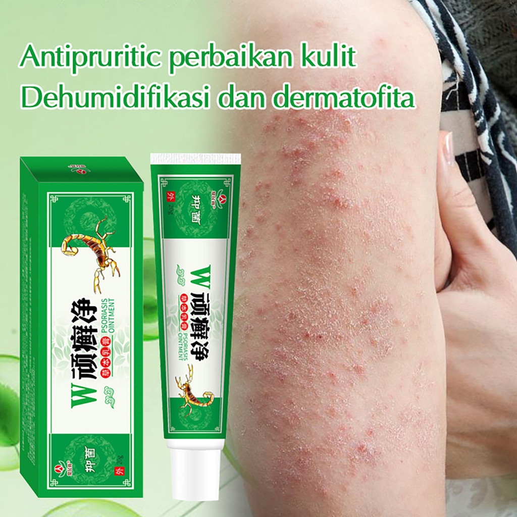 COD Salep obat kulit gatal Gatal - Obat Gatal Selangkangan Eksim Dan Jamur Budug Bernanah Scabies Ma