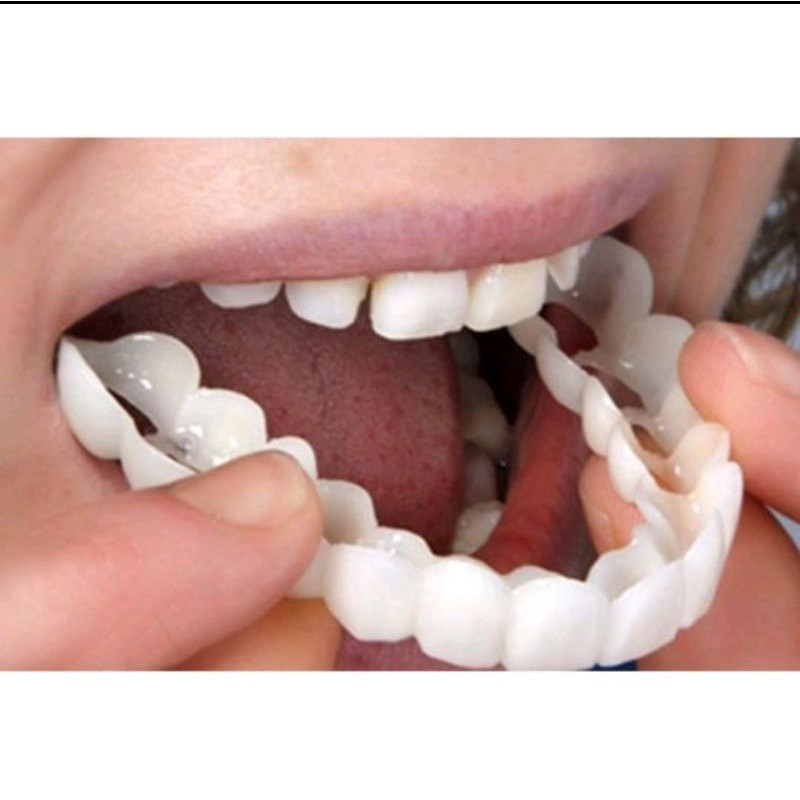 COD SMILE GIGI PALSU ATAS BAWAH GIGI PALSU LEPAS PASANG VENEER snap on smile