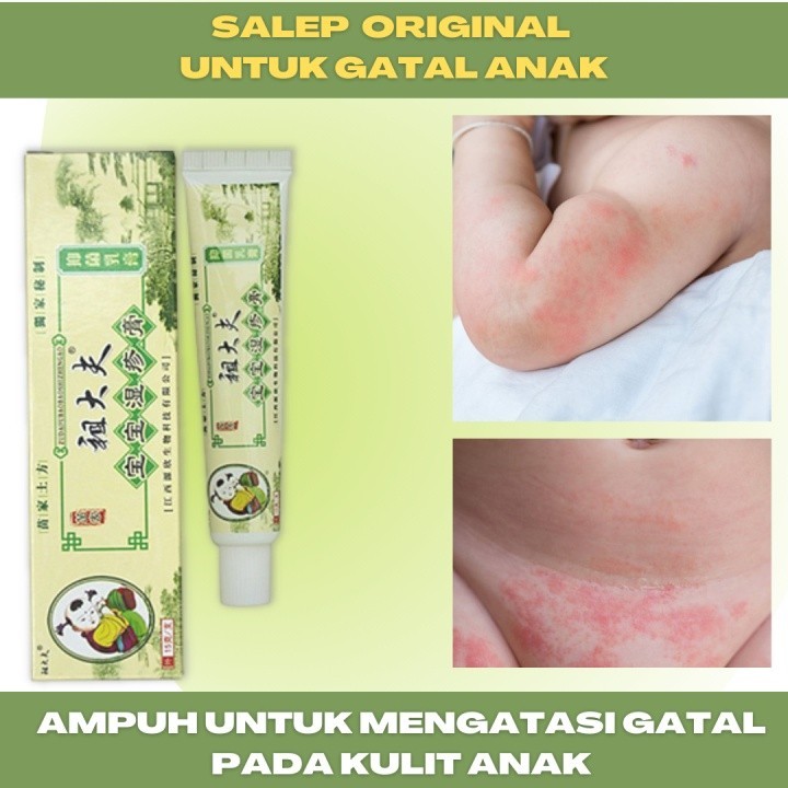 ZUDAIFU ANAK 15gr Original 100% - Salep Zu Dai Fu Khusus Anak Bayi Balita - Krim Cream Obat Gatal