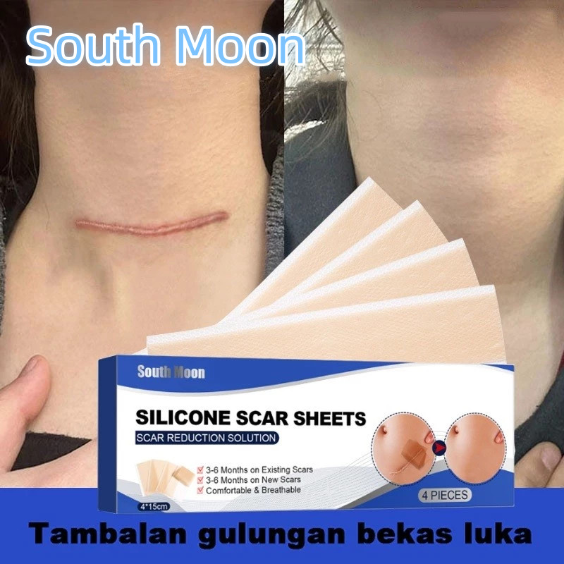 South Moon Silicone Scar Sheet Gel 4PCS 4cm x 7.5cm plester silikon penghilang keloid bekas luka Ple
