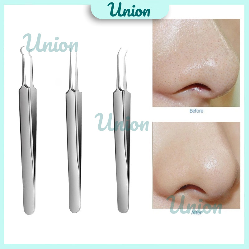 UM Alat Pencabut Komedo / Pinset Jepit Komedo Stainless Steel / Pinset Jepit Jerawat / Bengkok / Pem