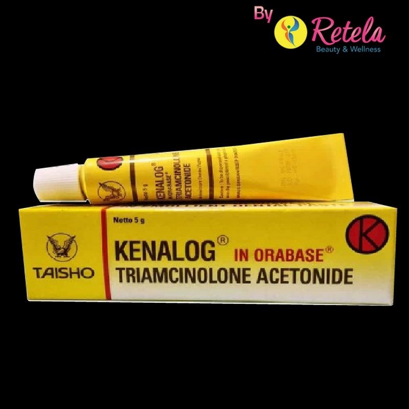 Kenalog in Orabase 0.1% Salep 5 g