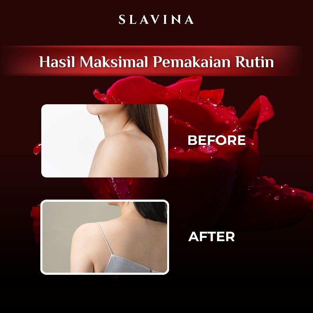 SLAVINA Body Lotion Memutihkan Red Opium Niacinamide with Serum Burst Glutathione