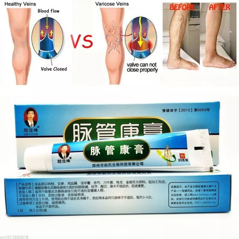 MAIGUANKANGGAO OBAT VARISES SALEP HERBAL CINA / Salep Penghilang Varises