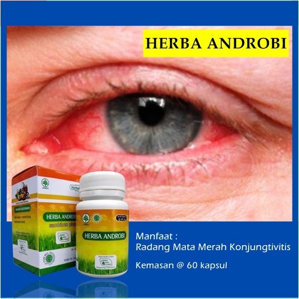 Obat Mata Konjungtivitis Mata Merah Dan Gatal BPOM 60 Kapsul Original