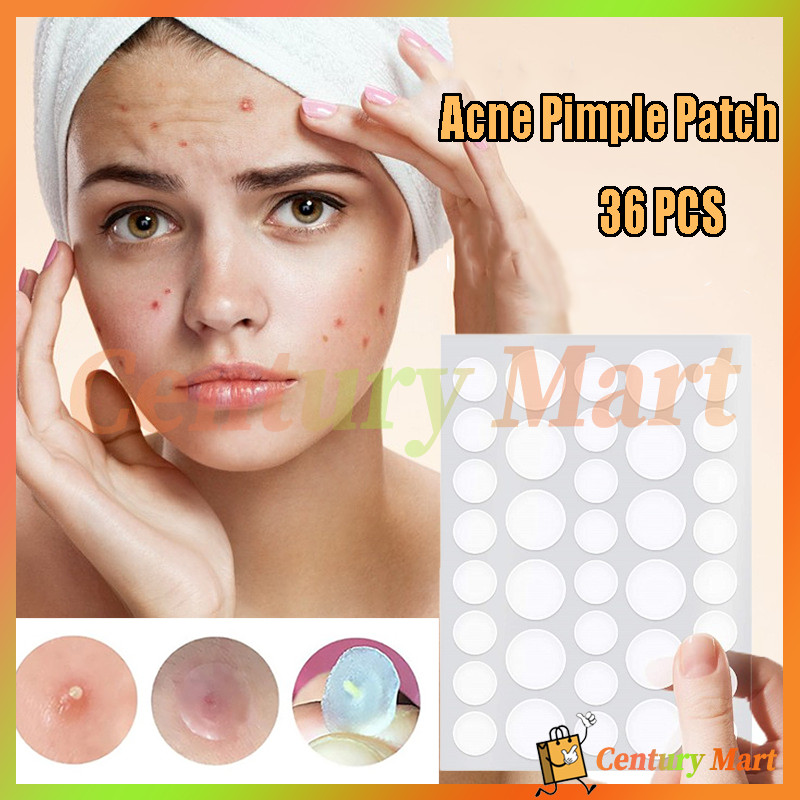 36Pcs/Set Acne Pimple Patch/Stiker Penghilang Jerawat/Acne Pimple Patch 36 pcs Acne Plasters/ Acne T