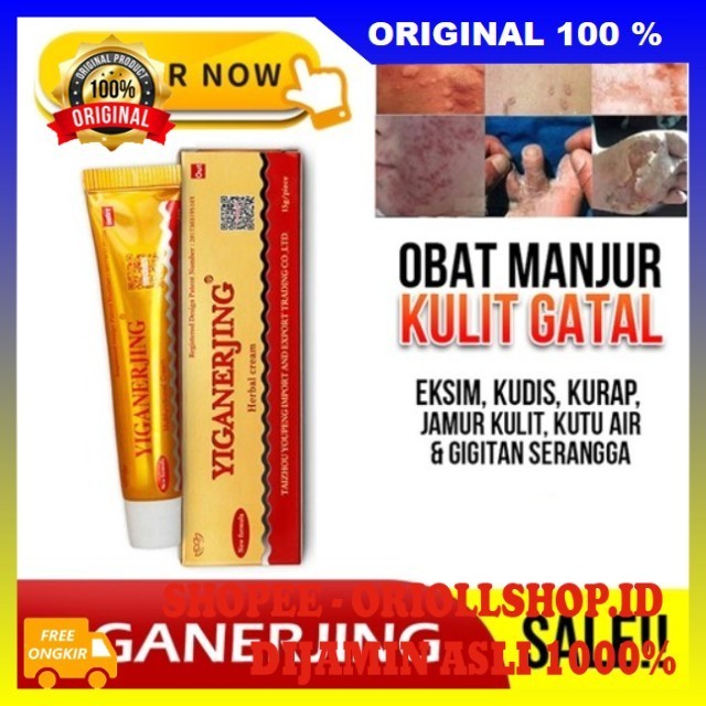 Salep Herbal Yiganerjing Psoriasis Dermatis Obat Gatal Kulit Eksim 100% ASLI