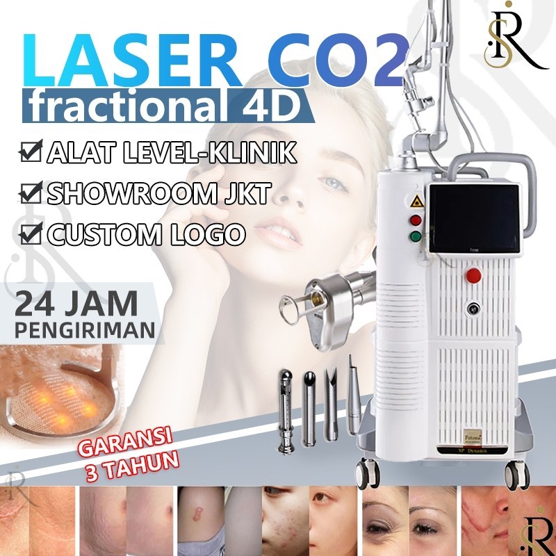 Laser co2 fractional alat klinik kecantikan  laser stretch mark Laser bekas luka alat laser penghilang bekas luka