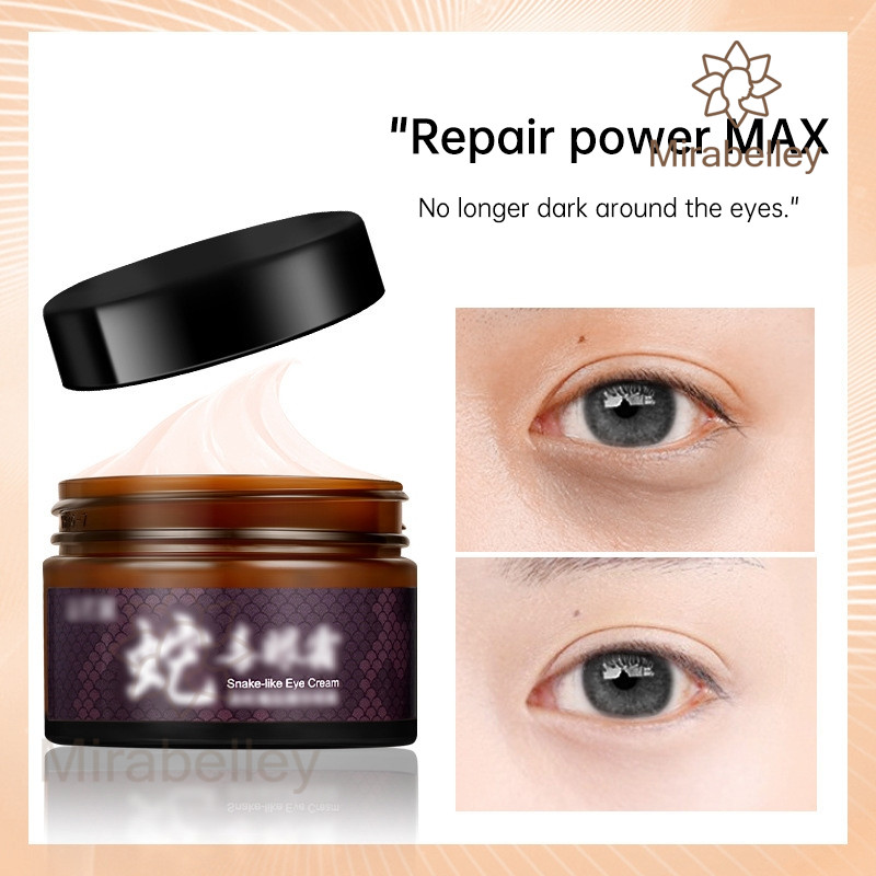 COD⚡ Krim Mata Anti-Bengkak Kerutan Perawatan Lingkaran Hitam 30g Anti-Penuaan Serum Mata Penghilang