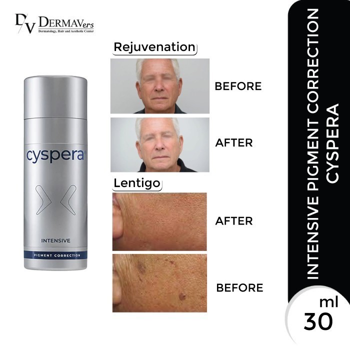 

PROMO!! -Cyspera Intensive Pigment Correction 30ml