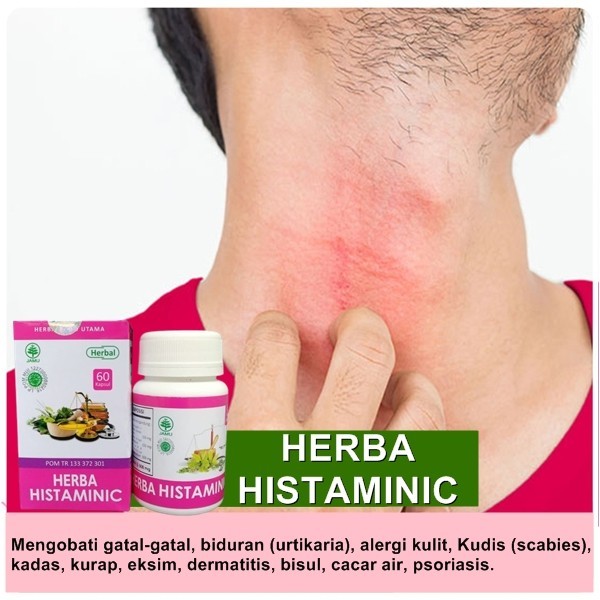 Obat Gatal Biduran Menahun Gatal Kulit Seluruh Badan Cacar Air Ampuh BPOM