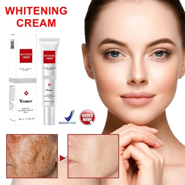 Krim Penghilang Bintik Hitam Pemutih Wajah Whitening Blemish Youbuy