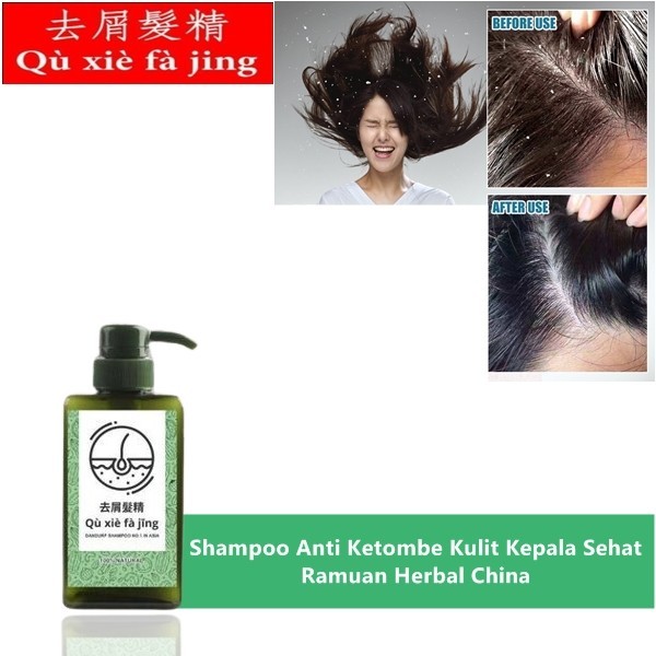 Sampo qu xie fa jing obat ketombe parah anti ketombe basah dan kering