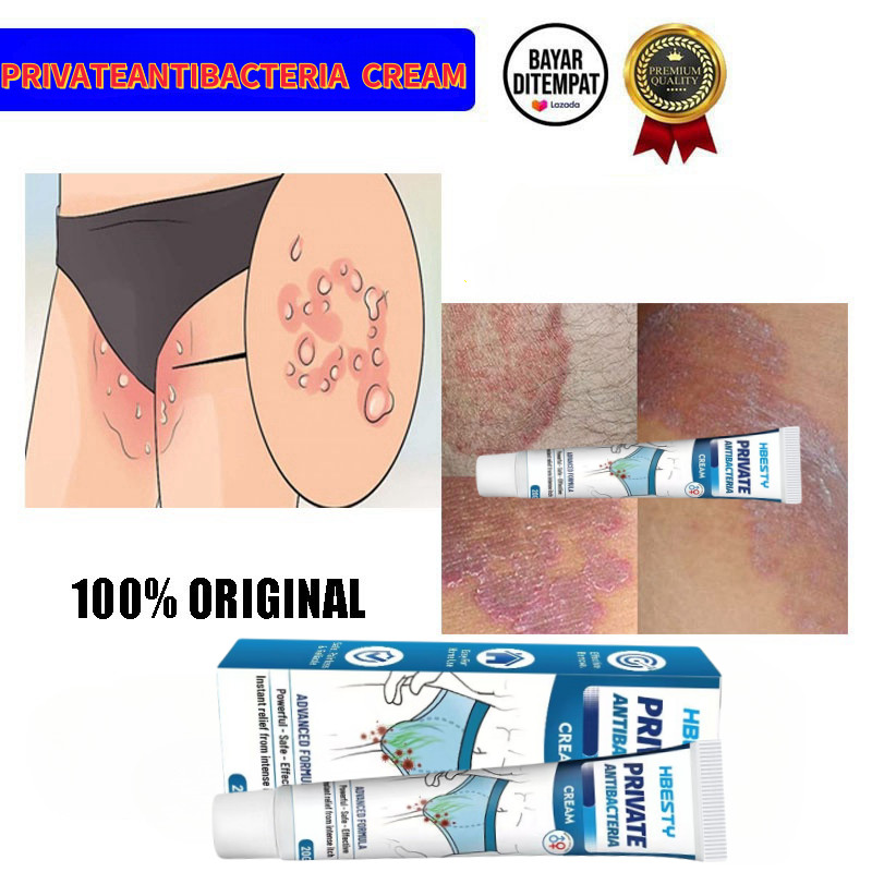 HBESTY salep gatal paling ampuh Anti jamur Salep salep gatal selangkangan selangkangan Salep gatal p