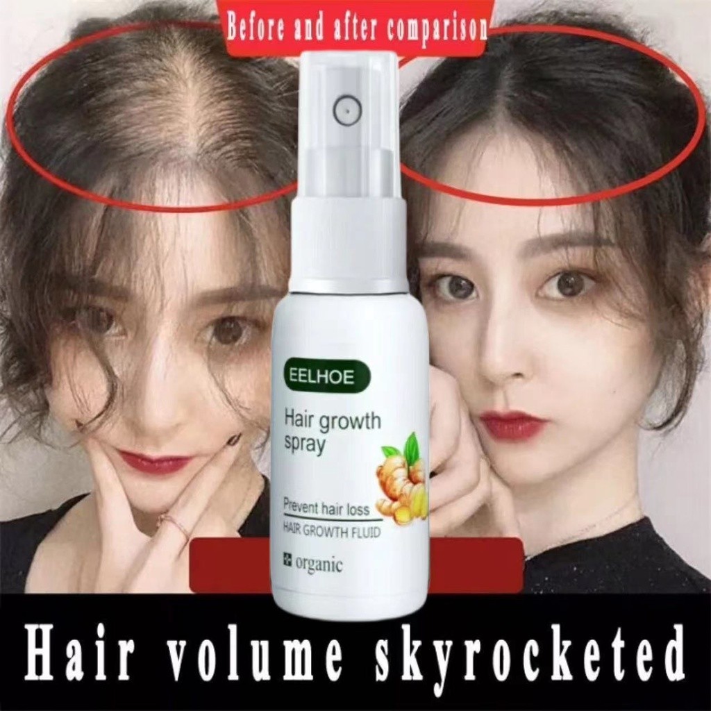 EELHOE Hair Growth Spray Pertumbuhan Rambut Untuk Pria Dan Wanita Spray Penebalan Rambut Ginger Germ