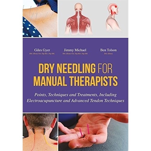 

Dry Needling for Manual Therapists: Points, Techniques and Treatments