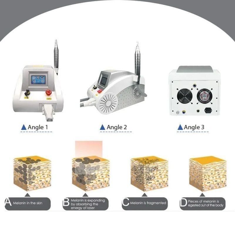 New. ND YAG Alat Laser Picosecond Alat Laser Picolaser / Laser Tatto Removal / Alat Penghilang Tatto