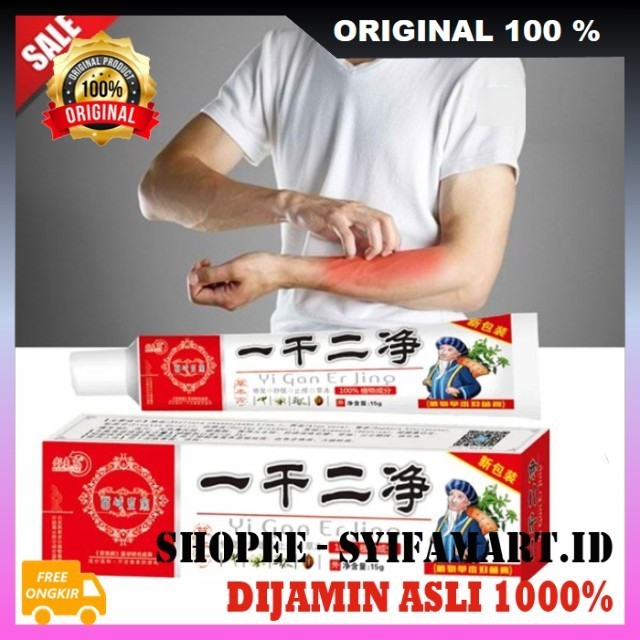 Salep Ajaib Yi Gan Er Jing Salep Gatal, Panu, Kurap, Eksim, Jamur Ampuh Untuk Dewasa dan Anak-anak 1