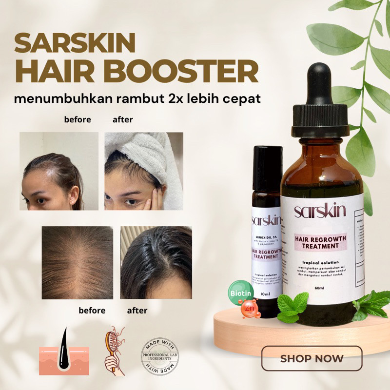 SARSKIN Serum Penumbuh Rambut Wanita/Pria • Penumbuh rambut rontok, botak, jenong