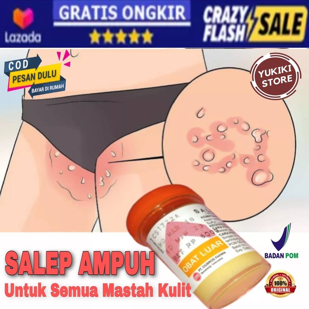 Salep Gatal Zwafel 24 Original Salep Obat Ori Cream Bandung Zwafel24 Kulit Itchy Skin Ointment Salep