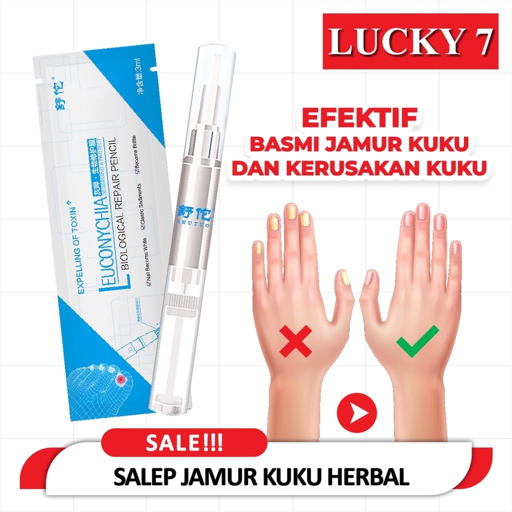 Obat Perawatan Jamur Kuku Jari Tangan Kaki Salep Jamur Kuku Ampuh