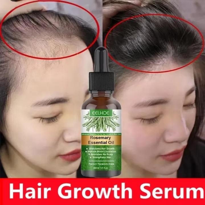 Rosemary Oil Rambut Penumbuh Rambut Botak Perawatan Rambut Rontok Penumbuh Rambut Cepat Hair Growth 