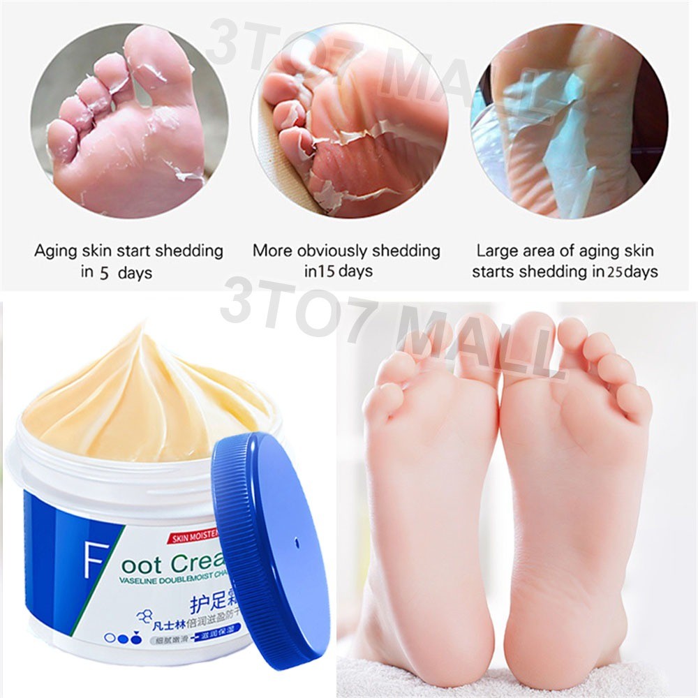 Obat kaki pecah pecah Cream kaki pecah dan kering Krim kaki Pecah Pelembab Kaki Kering Dan Pecah Pen