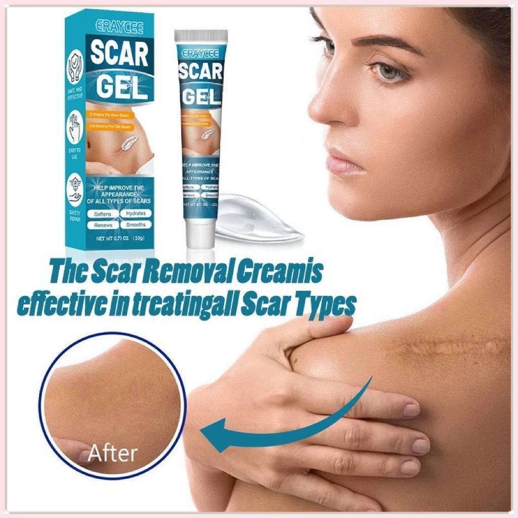 ERAYCEE Scar Remover Cream Scar Gel Penghilang Bekas Luka Koreng Advanced Scar Gel Dermatik Obat Bek