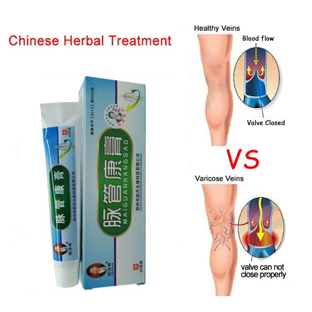 MAIGUANKANGGAO  Krim Salep China Varises Ampuh Mengobati Varises Kaki