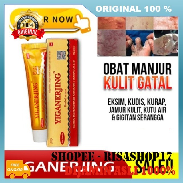 Salep Herbal Yiganerjing Psoriasis Dermatis Obat Gatal Kulit Eksim 100% ASLI