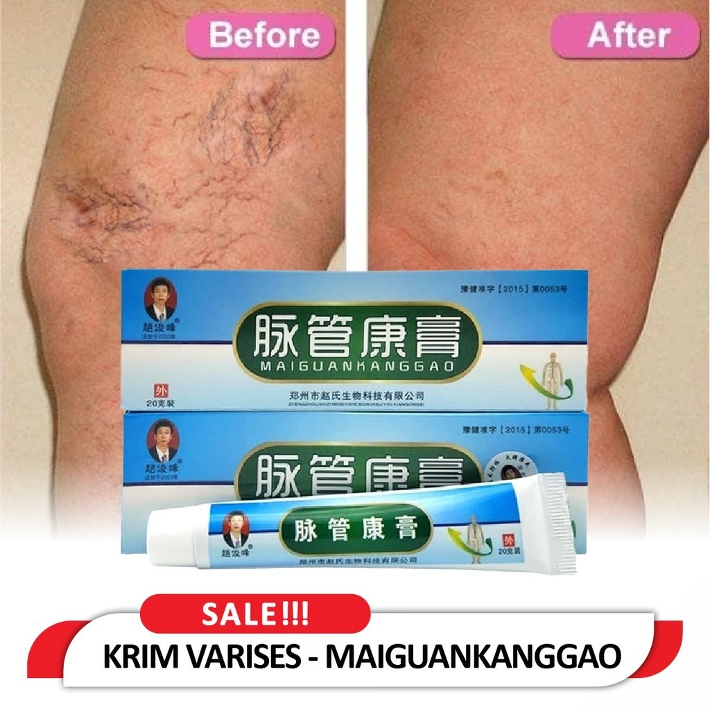 [ ORIGINAL ] MAIGUANKANGGAO SALEP OBAT CHINA KRIM SANGAT AMPUH MENGHILANGKAN VARISES KAKI