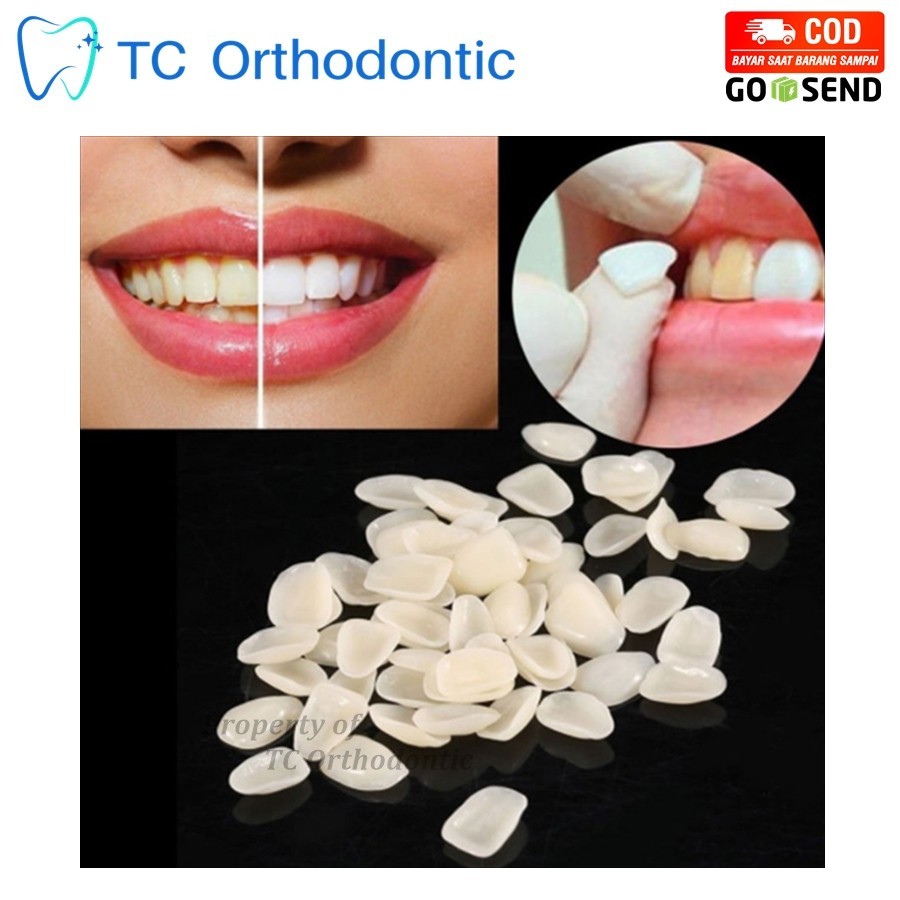 50 Buah Veneer Gigi Porselen Jaket Gigi / Gigi Palsu Penambal Ompong /Zahn Pro / Penutup Gigi