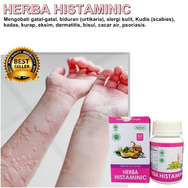 Kapsul Obat Gatal Gatal Di Selangkangan Kudis Eksim paling Ampuh Original
