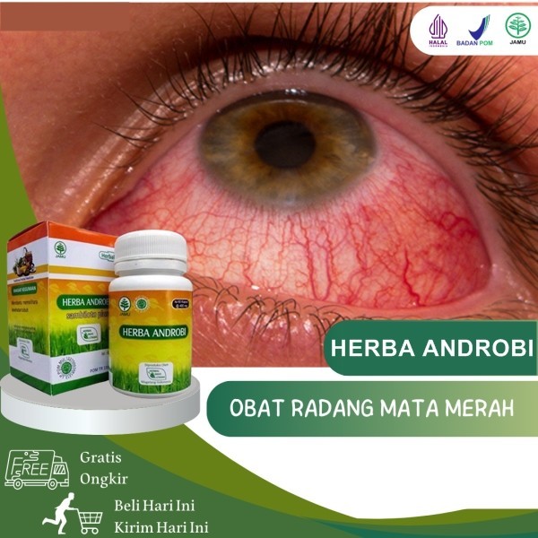 Obat Mata Konjungtivitis Mata Merah Dan Gatal BPOM 60 Kapsul Premium