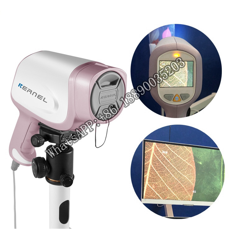 Peralatan mesin kamera Colposcope Video serviks elektronik colposkopik Kernel colposkopik untuk kn-2200 ginekologi