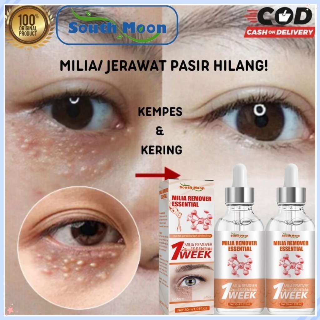 South Moon Milia Remover Minyak Essensial 7 days Serum Penghilang Milia Kutil di bawah Mata Eye Mili