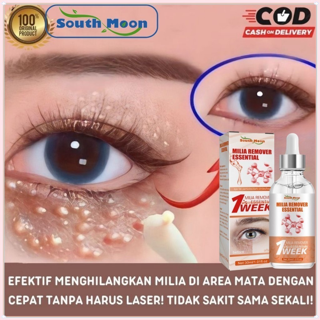 South Moon 7 days Serum Penghilang Milia Kutil di bawah Mata Eye Milia Remover Eye Fat Removing Gran