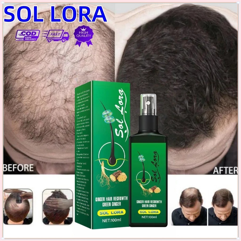 SOL LORA Hair Growth Spray PENUMBUH RAMBUT 100ml Penumbuh Rambut Wanita Pria Secara Cepat Obat penum