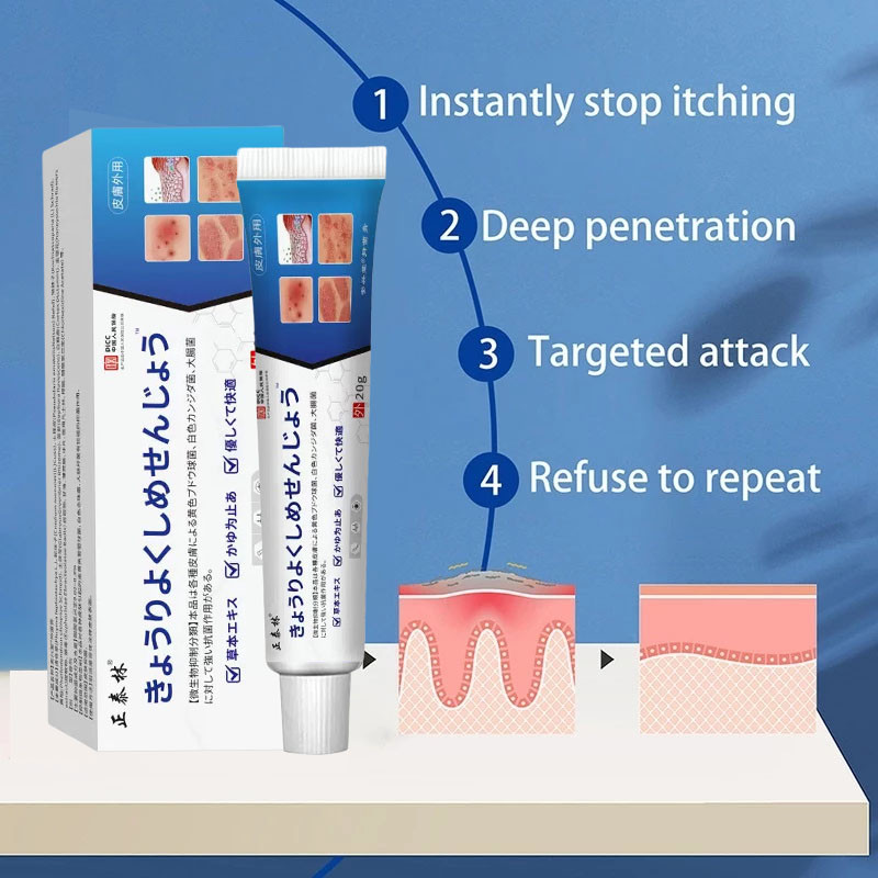 Salep Alergi Kulit Gatal Eksim Salep Gatal Kulit Ampuh Cina gatal selangkangan 20g Cocok untuk