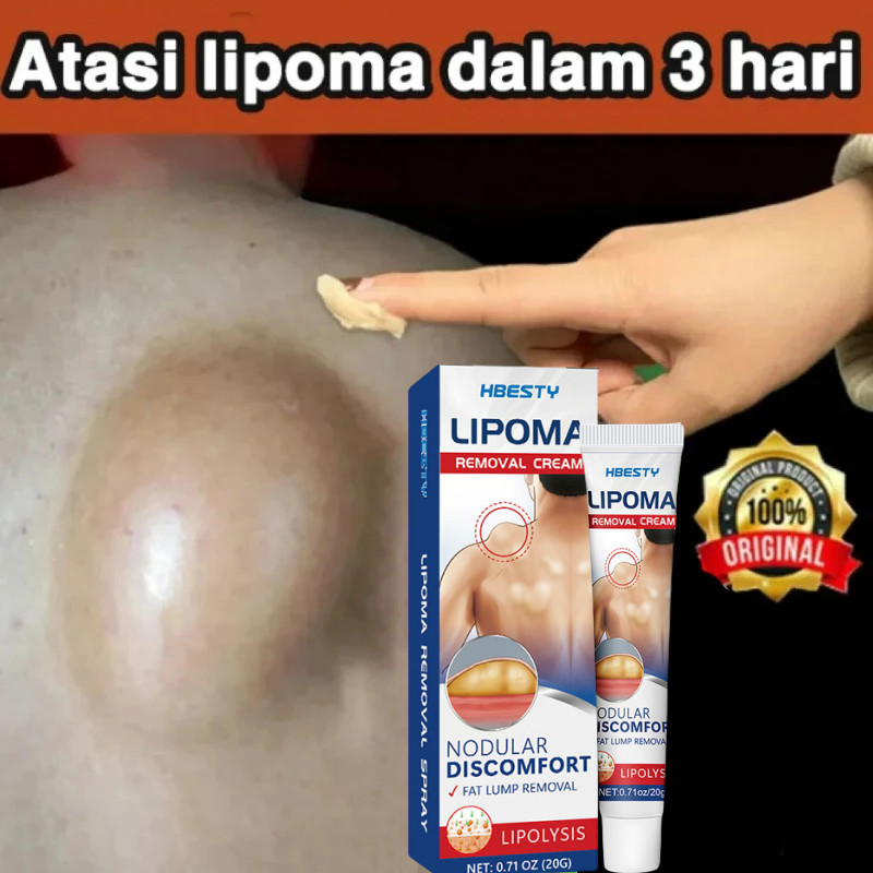 Obat Benjolan Lipoma Obat herbal Cina Krim lipoma 20g Perawatan punggung/leher/paha Kanker Tumor Kel