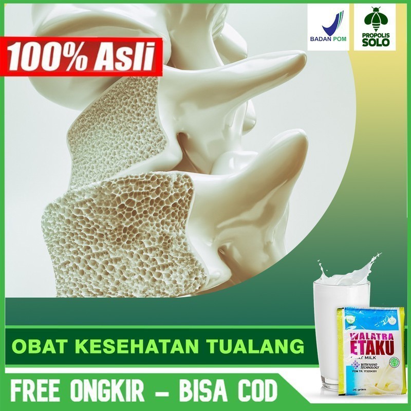 

Susu Kesehatan Tulang - Susu Kalsium - Tulang Keropos Yang Aman Susu Kambing Etaku