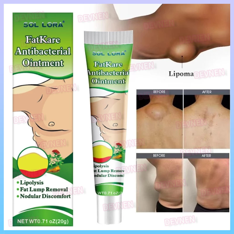 Lipoma Cream 20g salep lipoma salep benjolan Obat Lipoma Obat Benjolan Penghilang Benjolan