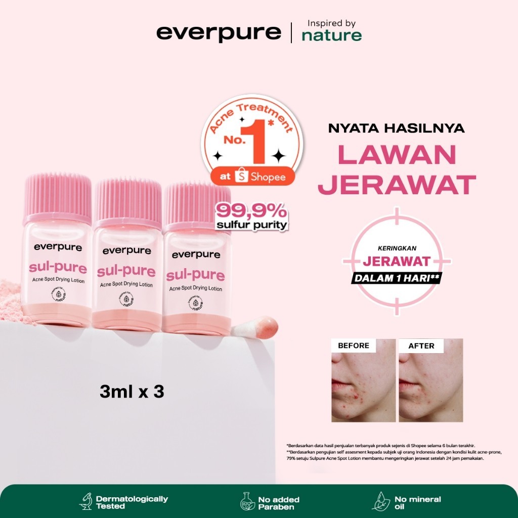 [BUNDLING] EVERPURE Sul-pure Acne Spot Drying Lotion 3ml x 3pcs (Special Affiliate) - Obat Totol Men