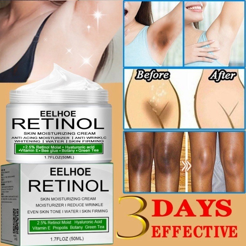 Krim Pemutih Ketiak Pemutih Selangkangan Vagina Pembersih Selangkangan Hitam Krim Pemutih Ketiak Pem