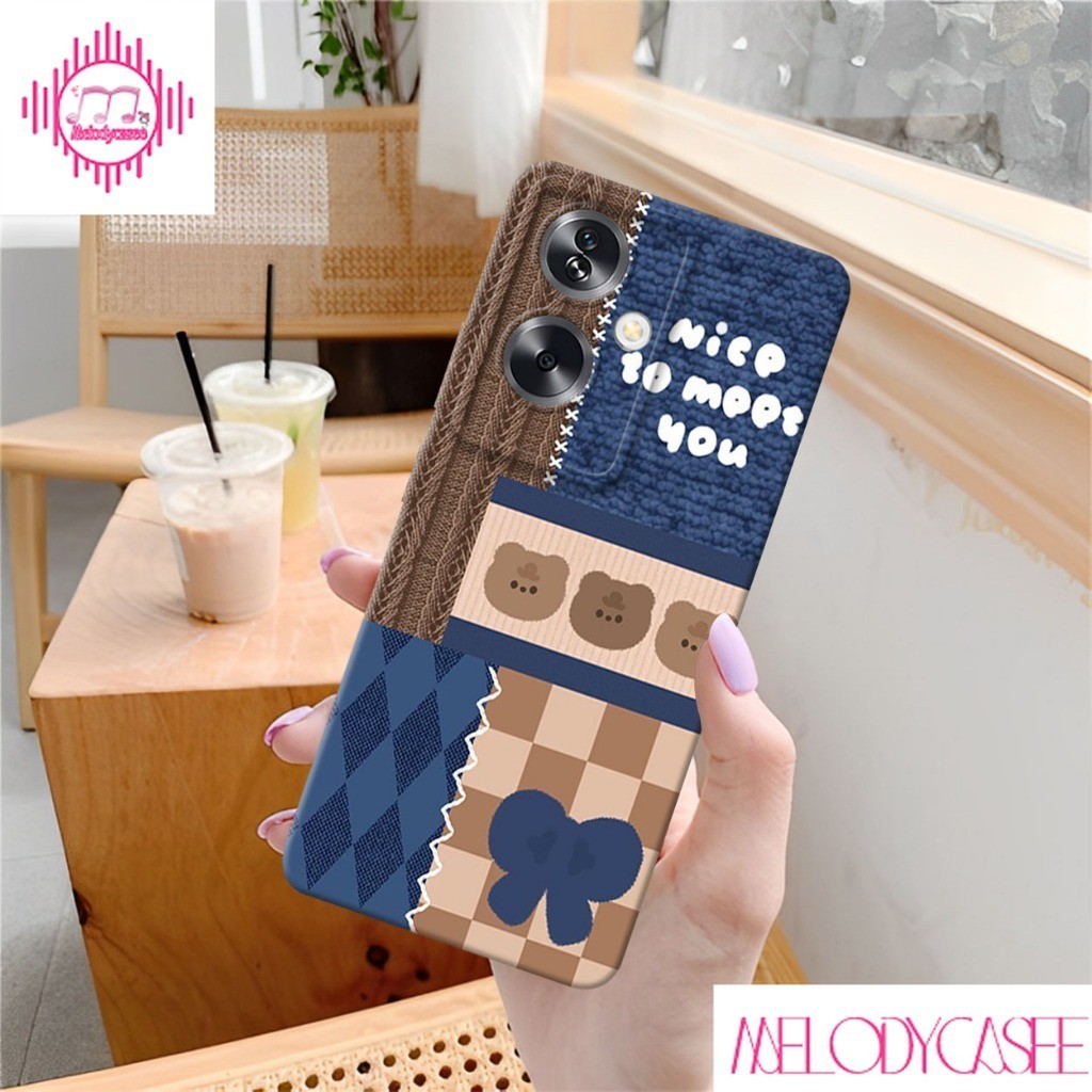 Case Untuk OPPO A79 5g Motif Softcase Lentur Pro Kamera Pelindung