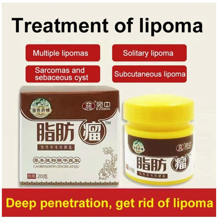 Lipoma Removal Cream salep lipoma salep benjolan Krim Penghilang Lipoma Salep Pengangkatan Lipoma Kr