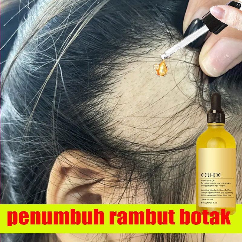 Rosemary Oil Rambut Penumbuh Rambut Botak Perawatan Rambut Rontok Penumbuh Rambut Cepat Hair Growth 